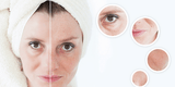 womans face with hair in towel, showing up close skin images 