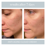 the best tallow cream for acne, before and after picture of the anti-aging cloud cream for clear skin